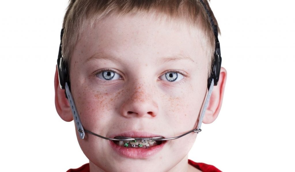 boy wearing headgear braces - ss220324